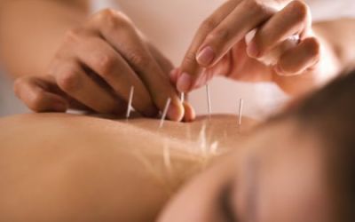 Acupuncture Ajax